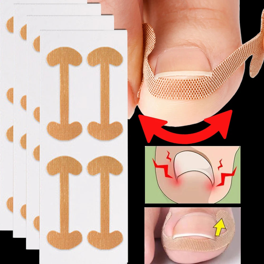 #1 Toenail Correction Strips