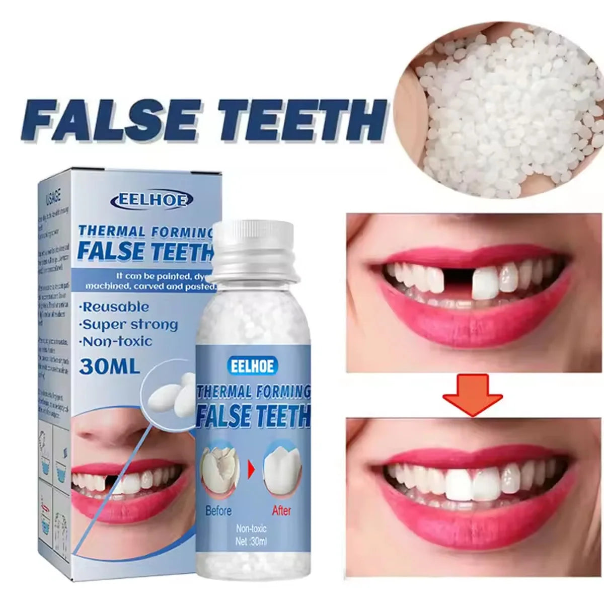Tooth Repair Kit