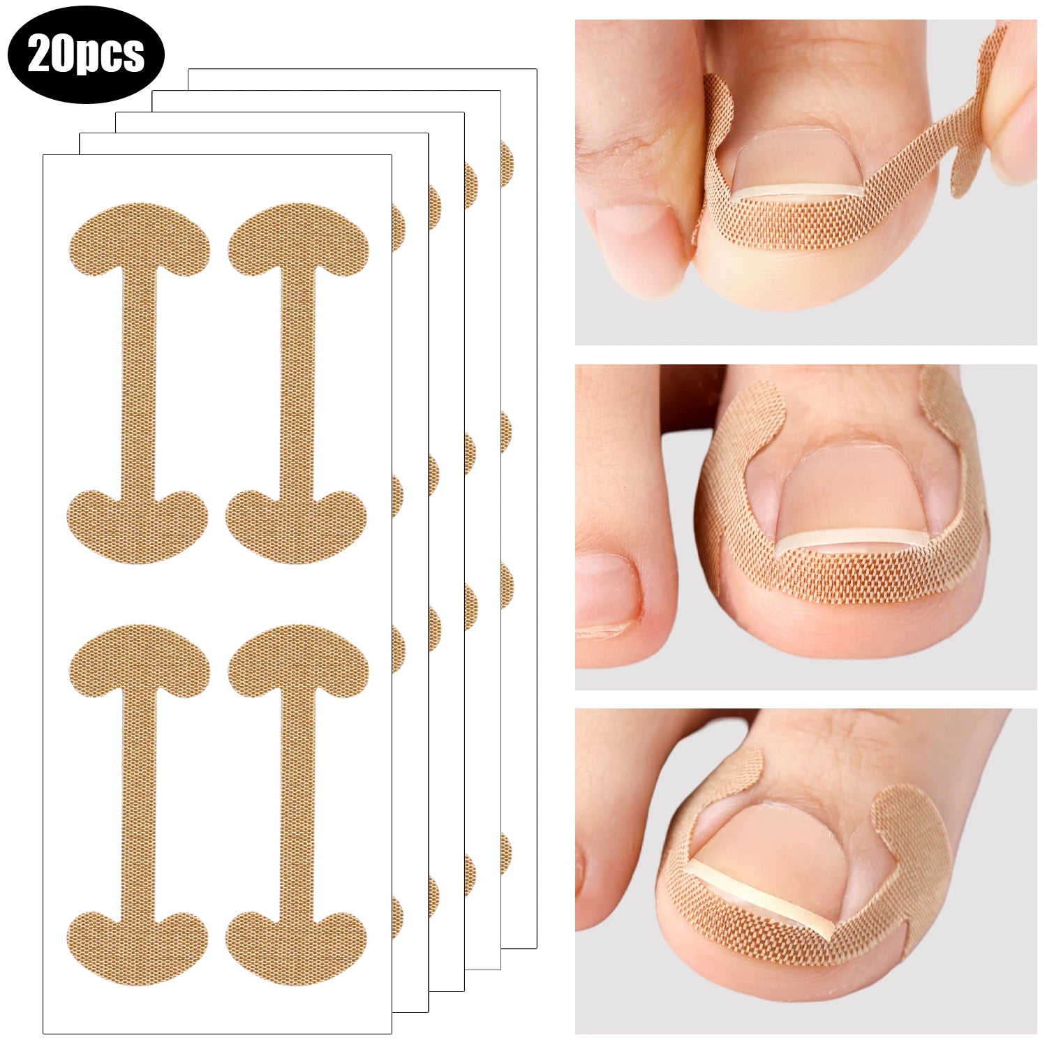 #1 Toenail Correction Strips