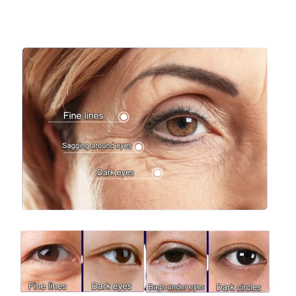 Instant Eye Tightener