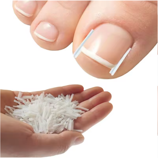 #1 Toenail Correction Strips