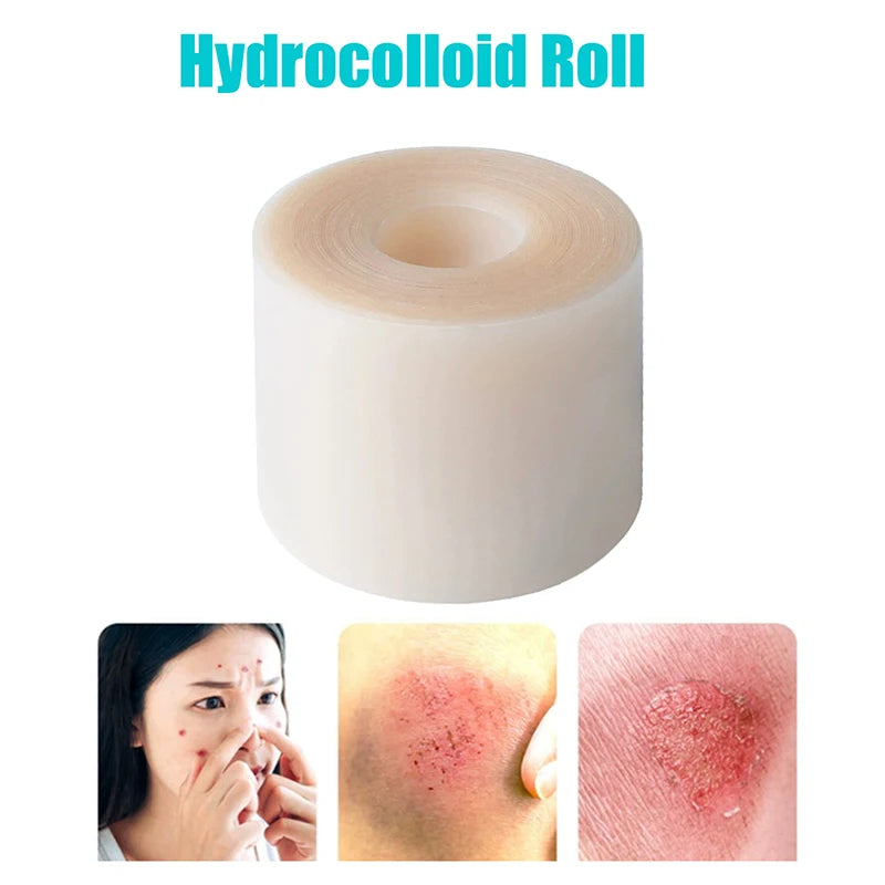 Hydrocolloid Roll Bandage