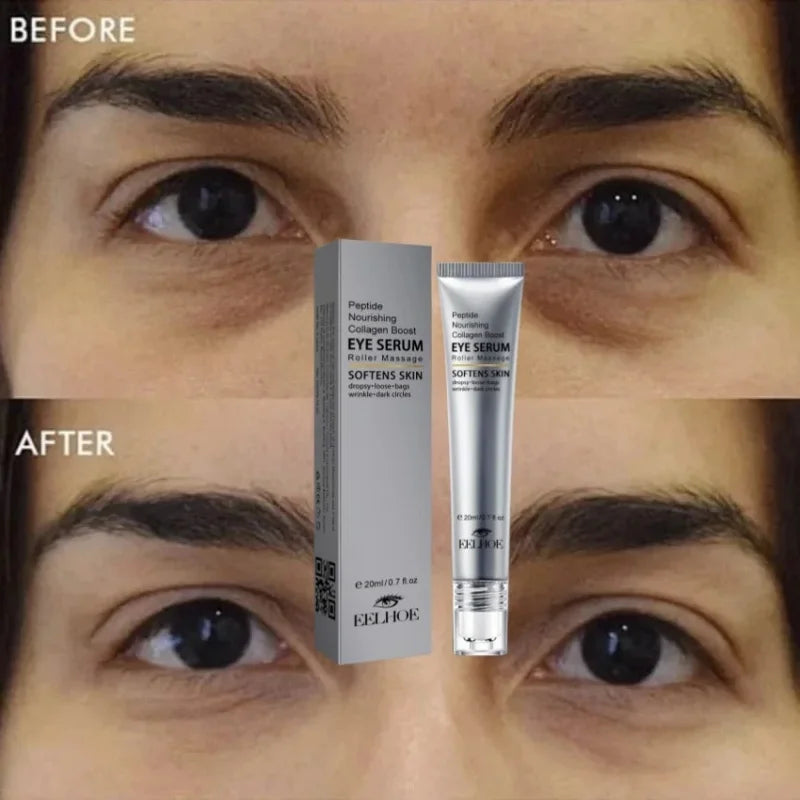 Instant Eye Tightener