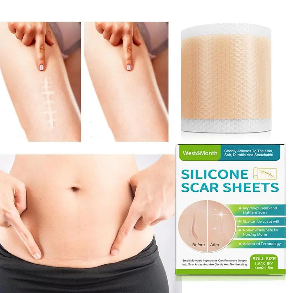 Silicone Scar Sheets