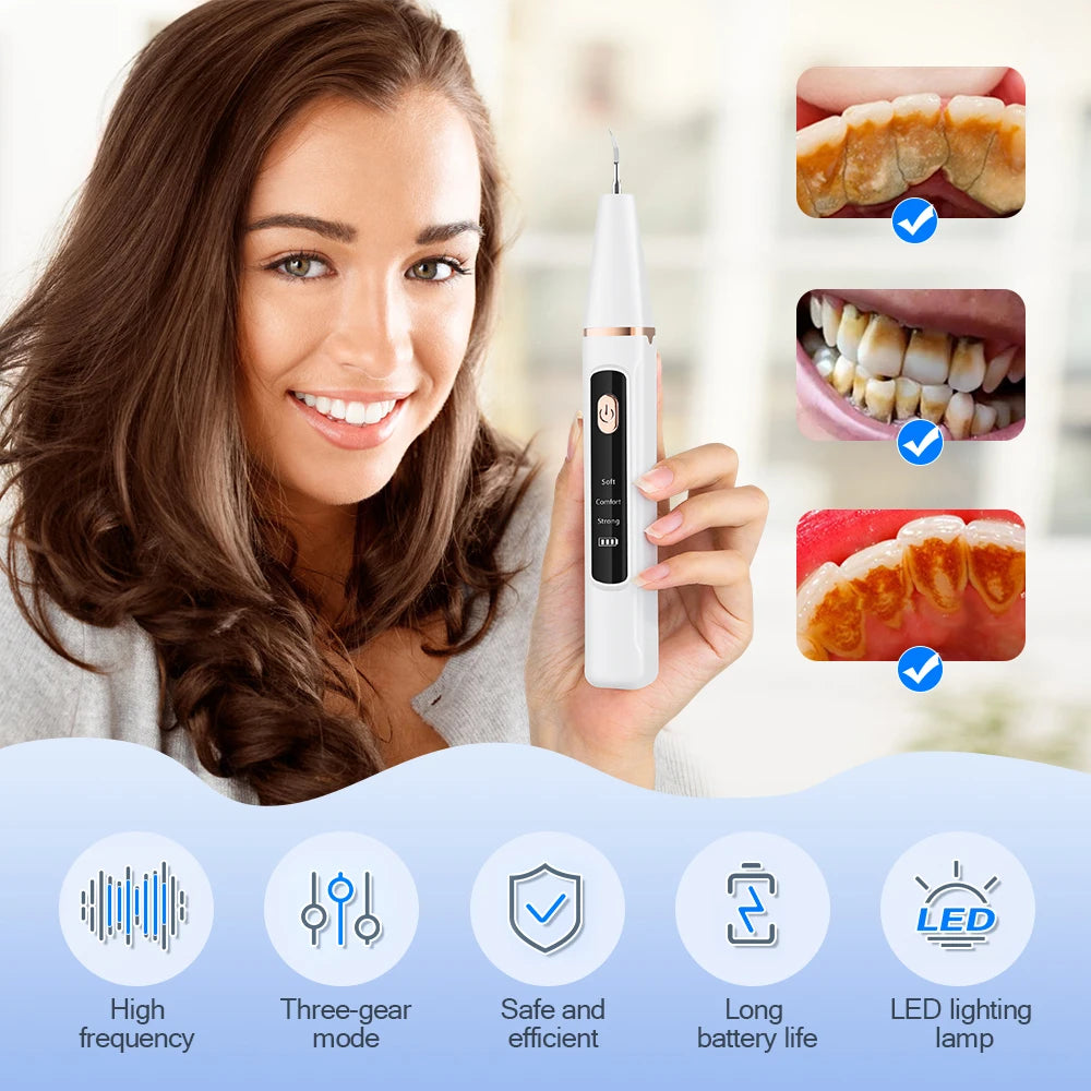 #1 Electric Teeth Cleaner