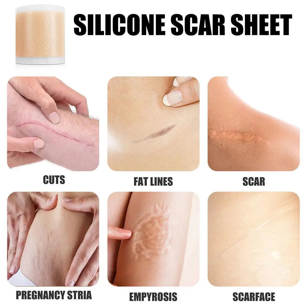 Silicone Scar Sheets