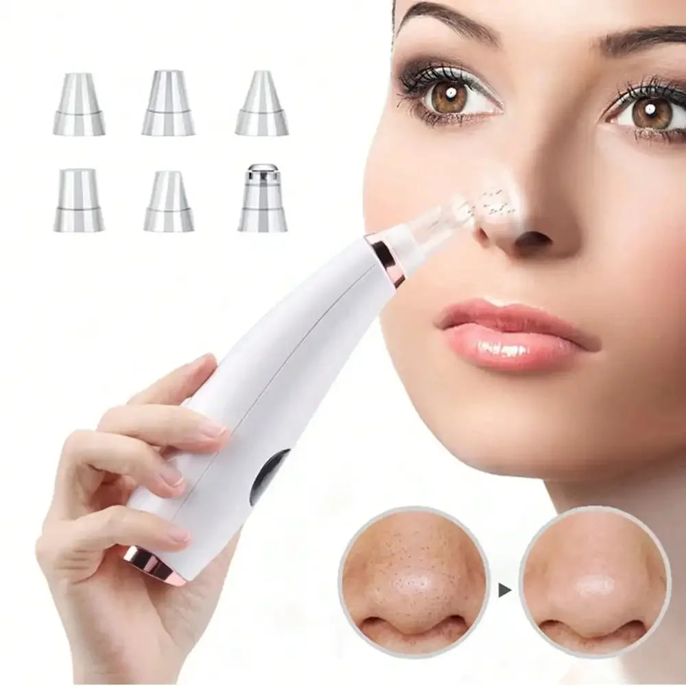 Electric Blackhead/Acne Remover