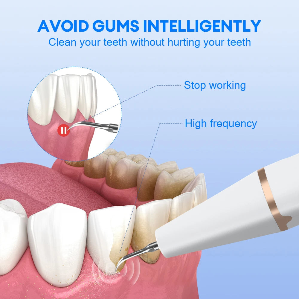 #1 Electric Teeth Cleaner